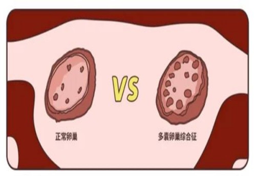 不孕什么时候去医院检查,没怀上可以挂生殖科进行检查